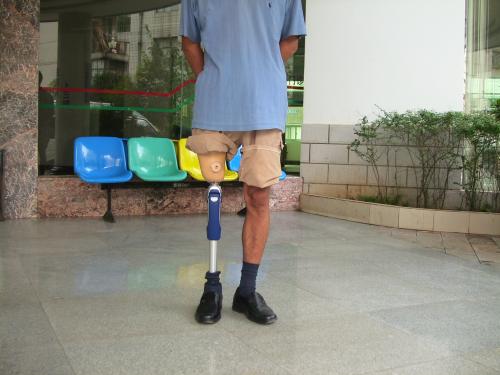 力康小腿假肢價格安裝時注意哪些事項(圖1) 力康小腿假肢價格安裝時注意哪些事項(圖1)