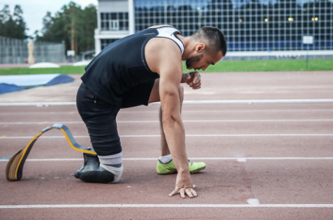 截肢患者初次安裝假肢時注意什么怎么做較好(圖1) 截肢患者初次安裝假肢時注意什么怎么做較好(圖1)