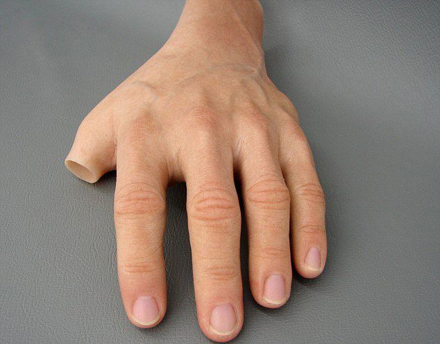 安裝一個左手假肢價格多少錢(圖1) 安裝一個左手假肢價格多少錢(圖1)